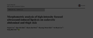 Lee S, Kim HJ, Park HJ, Kim HM, Lee SH, Cho SB. Morphometric analysis of high-intensity focused ultrasound-induced lipolysis on cadaveric abdominal and thigh skin. Lasers Med Sci. 2017 Jul;32(5):1143-1151. doi: 10.1007/s10103-017-2220-z. Epub 2017 Apr 27.