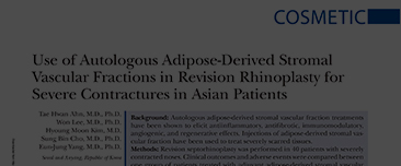 Ahn TH, Lee W, Kim HM, Cho SB, Yang EJ. Use of Autologous Adipose-Derived Stromal Vascular Fractions in Revision Rhinoplasty for Severe Contractures in Asian Patients. Plast Reconstr Surg. 2021 Mar 1;147(3):401e-411e. doi: 10.1097/PRS.0000000000007623. PM
